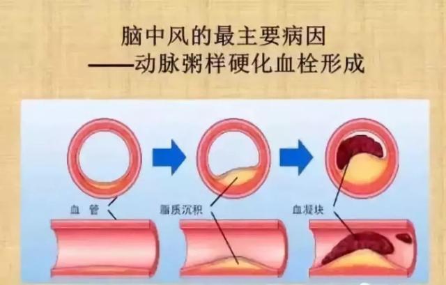 小分子肽对心脏的作用 2026年最新小分子肽对心脏的作用