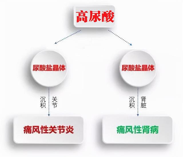 爱喝酒的痛风人直接吃别嘌醇，危害可能比长期吃激素、止痛药还大