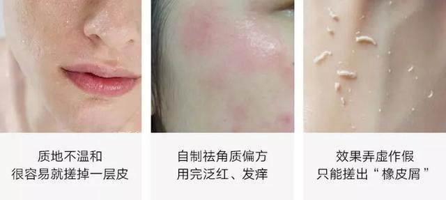 去粉刺毛囊炎痤疮鸡皮身体乳