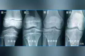 7岁女童戴B罩杯文胸来大姨妈，炸鸡豆浆蜂蜜都不是真凶图片