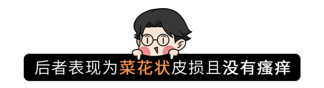 疥螨到底是什么？感染后有何症状？这2种传播途径，男女都要小心