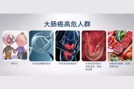 常规体检完全没必要做PET-CT图片