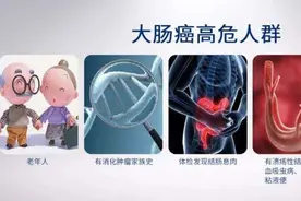 常规体检完全没必要做PET-CT图片
