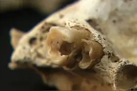 千古历史之谜曹操墓：古墓中的牙齿蛀牙严重，证实生前头疼的病因图片