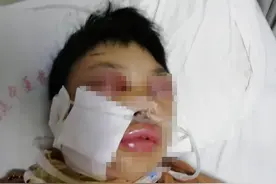 小心，蛇出没！半个月福建多人被“放倒”图片