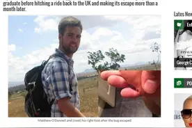 英男在非洲被沙蚤寄生 1个月后百颗虫卵从脚底爆出图片