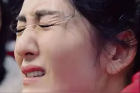 谢娜的脸怎么了？是车祸后遗症，还是医美痕迹？图片