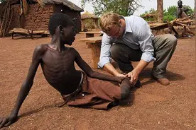 长1.2米入侵人体，可怕寄生虫肆虐非洲，350万人痛苦不堪图片