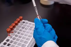 乙肝表面抗原转阴了？先别高兴得太早，还要看看这两项指标图片
