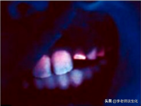 氨基酸衍生物代谢（三）