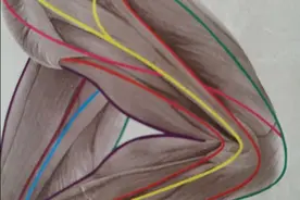 下肢痛不一定都是坐骨神经痛，要提高认识，才能有的放矢疗效好图片