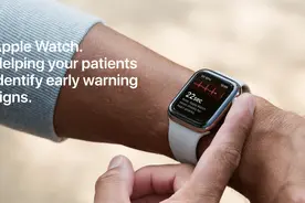 国行Apple Watch的心电图获批了，但功能恐怕没那么强大图片