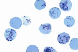 为什么要检查网织红细胞？图片