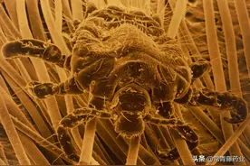 你知道阴虱是什么吗？治疗阴虱会有什么误区？为什么会久治不愈？图片