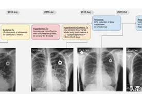双免疫治疗联合“高效且高毒”，这样使用副作用大幅降低图片