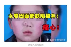 痛心！女婴因面部缺陷被弃废楼，18岁考上医学院，你支持认亲吗？图片