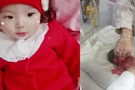 出生只有900克，早产“拇指姑娘”在呵护中健康成长图片