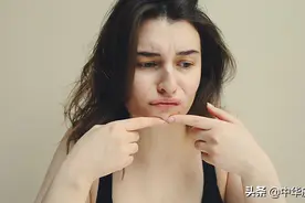 对付痘印和痘疤，这儿有招——图片