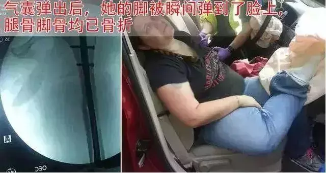 安全气囊到底是救人还是伤人，为什么那么多人被安全气囊打伤