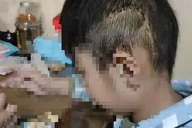6岁男孩被顶楼掉落的砖块砸中，后脑勺全是血！杭州高档小区这起高空坠物，听了心惊图片