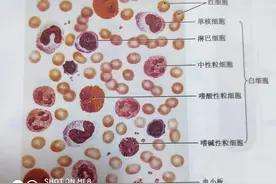 皮下有出血，原来是——血小板图片