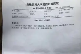合肥一男子在界首市人民医院被诊为脑梗死，去其他医院一查竟然没病图片