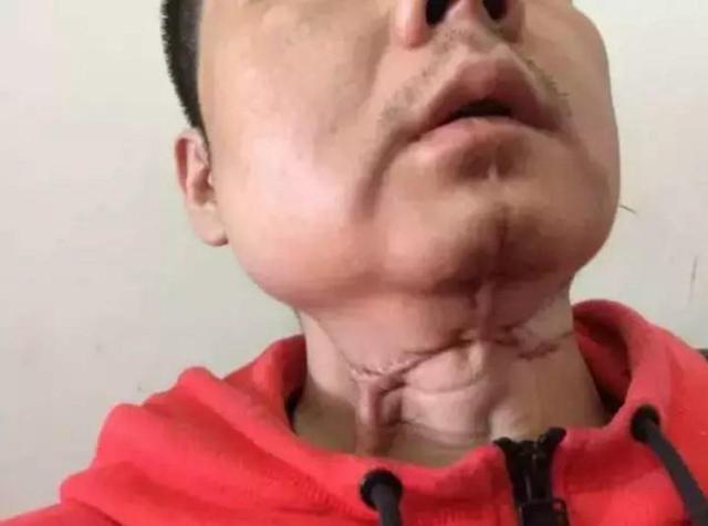 槟榔之殇：成瘾只是表象，6000万人的爱好，如何成割脸的诱因