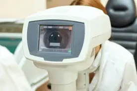 眼部异常看出血管问题图片
