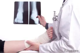 一次崴脚，次次崴脚，崴脚还容易“上瘾”？图片