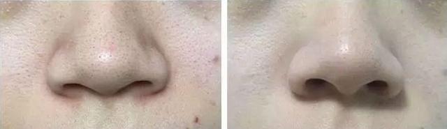 涓嶅埌鐧惧厓鐨勬皑鍩洪吀娲楅潰濂讹紝鑷甫娲侀潰鍒峰ご锛岀毊鑲よ秺娲楄秺婊戞簻