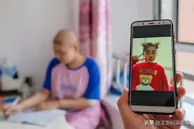 东北“大头娃娃”求医9年，病情加重终移植，能否重生仍未知图片