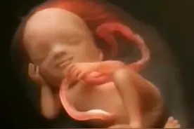 一般胎儿什么时候胎动活跃？6张动图告诉你，胎动时胎儿在干啥图片