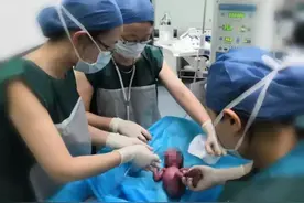 “吾家小女初长成” 910g超低出生体重儿康复出院啦！图片