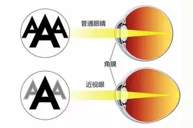 健康生活丨预防近视要从娃娃抓起（一）图片