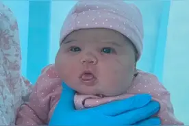 英国宝宝刚出生只有一个苹果重，13个月治疗后，她终于回家了图片