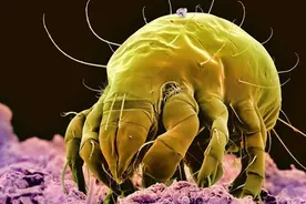 床上螨虫成窝，家里老人小孩老过敏，教你1个土法子，让螨虫消失图片