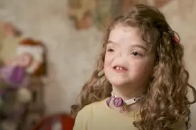 八岁女孩天生没鼻子，却活得比成年人更坚强，让人不得不佩服图片