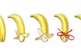 包皮手术小科普图片