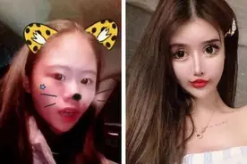 亲妈助力13岁女儿：花400万整容，却变成审美畸形的“怪物”图片