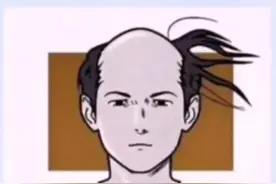 为什么秃顶的人宁愿留一圈头发，也不愿剃光头？搞笑评论（三）图片