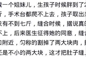 剖腹产可以顺便把多余的脂肪肉割了吗？图片