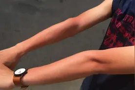 为什么你一晒就黑，别人却怎么也晒不黑？图片