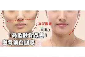 高低颧骨、颧骨前凸怎么办？一个动作，回收颧骨改变脸型图片