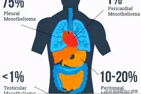 一级致癌物石棉，潜伏期可达数十年，你用过的这些物品可能都有图片