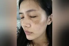 太久没“行事”导致黄褐斑？提醒：3个改变千万要注意图片