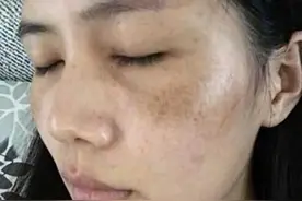 太久没“行事”导致黄褐斑？提醒：3个改变千万要注意图片