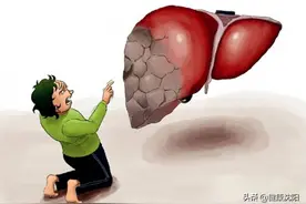 健康科普堂 | 保肝爱肝，警惕肝炎演化成肝癌图片