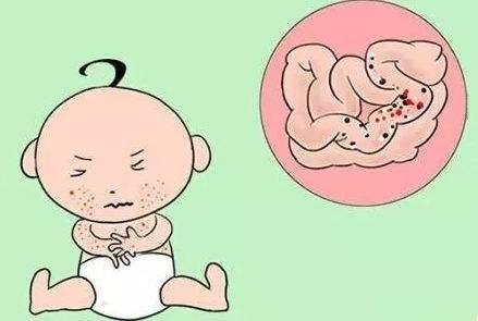 宝宝出现这些症状，说明“奶粉过敏”！你家孩子会这样吗？