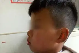儿子脸型像“大猩猩”，妈妈调侃“长残了”，朋友提醒才知不对劲图片