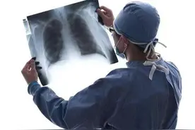 胸腔积液对癌症患者来说意味着什么？这个不好的征兆，一定要警惕图片